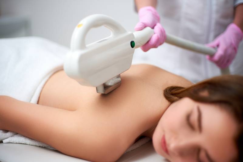 Épilation définitive du dos complet pour femme à Nancy : machine haute performance et soin professionnel dans notre institut