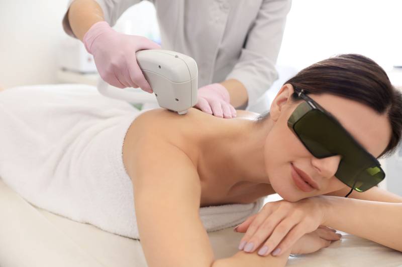 Épilation définitive épaules pour femme avec un laser triple onde et des résultats durables chez Laseva Esthétique à Nancy