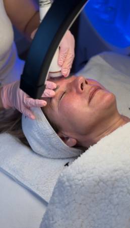 Notre zone d'activité pour ce service Séance de microneedling avec radiofréquence en institut